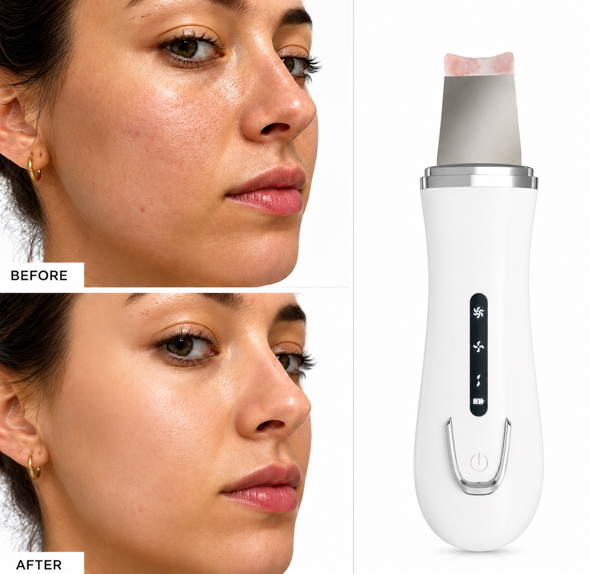 Solvane Electric Pore Cleaner